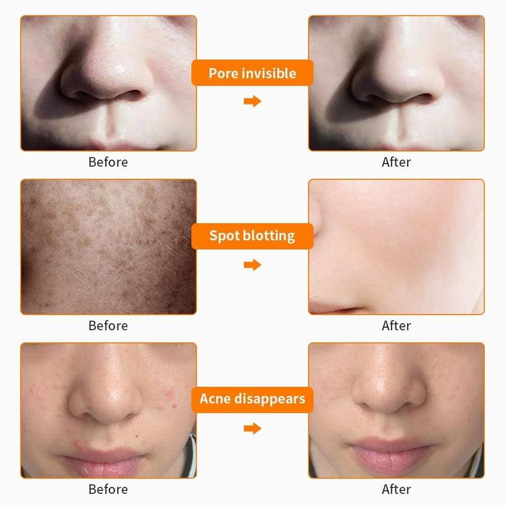 7 Colour LED Beauty Repair Face & Neck Mask - Skin Brightening, Acne, Wrinkles